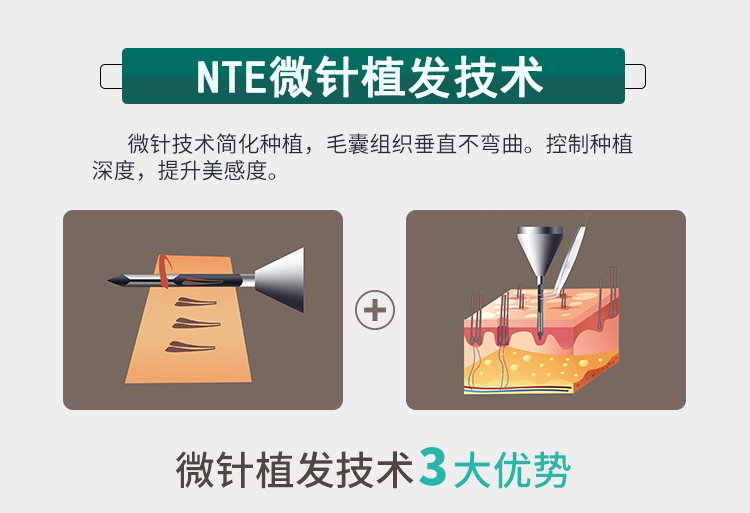 NTE΢ֲlg